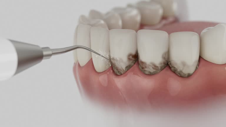 Reliable Dental Implants contractor in Thorsby, AL by Smile Center Dentistry